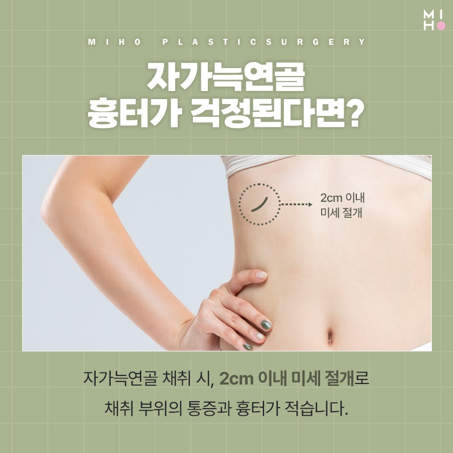 자가늑코수술 나에게 적합한 방식으로 관련 이미지 5