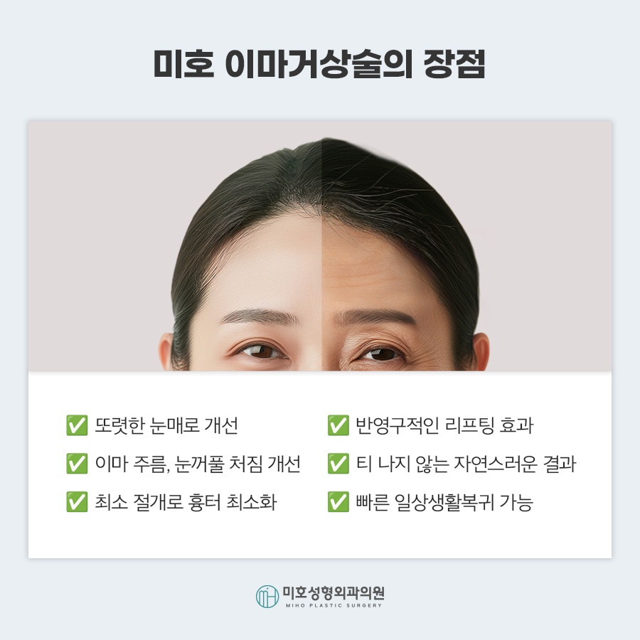이마거상비용 방법 비교 관련 이미지 6