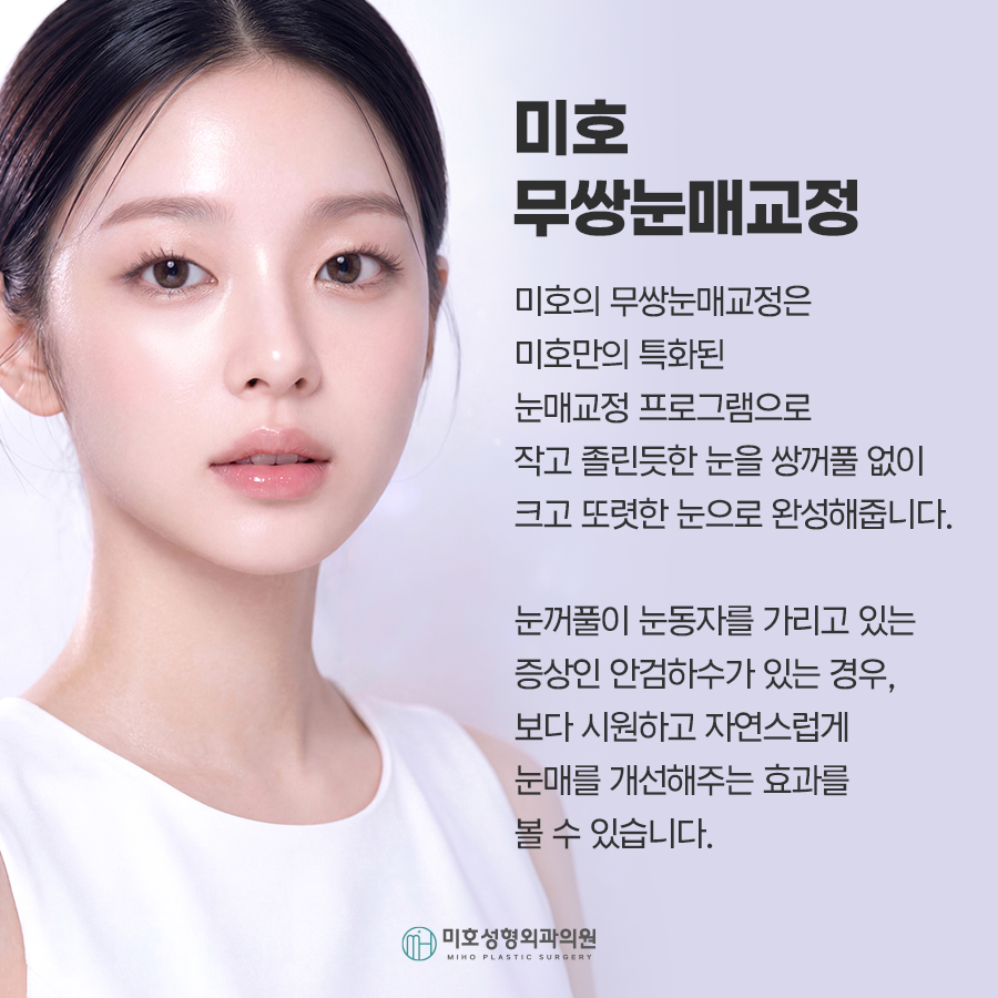 무쌍눈매교정 자연스러운 눈매 완성 관련 이미지 2