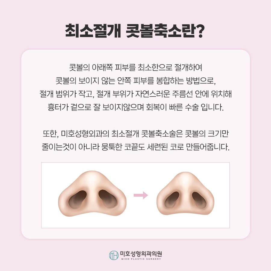 콧볼축소 자연스러운 코라인을 위한 체크포인트 관련 이미지 2