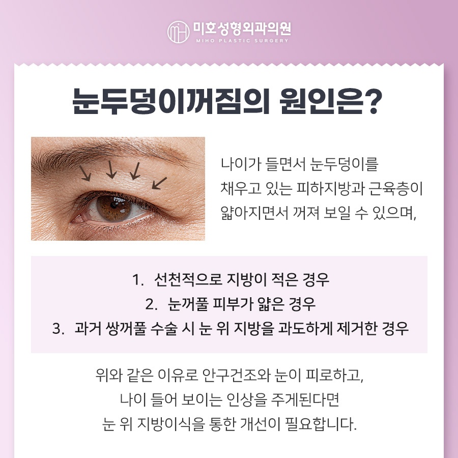 How to Naturally Improve Sunken Upper Eyelids image 2