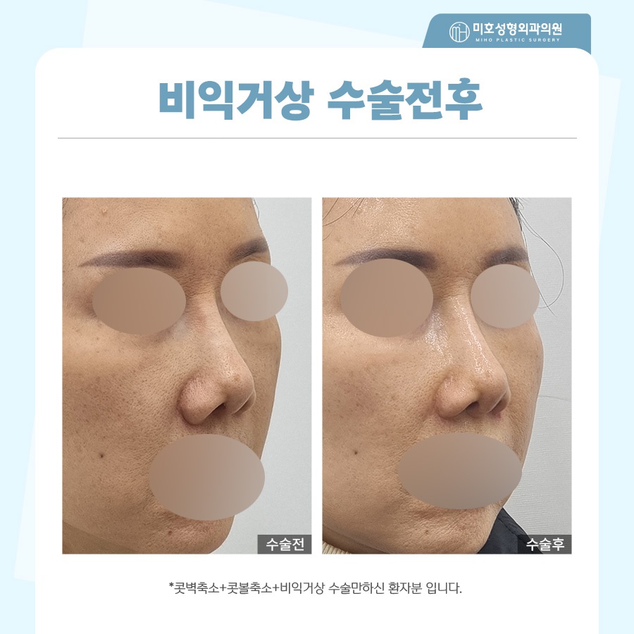 비익거상 개개인별 맞는 비율로 관련 이미지 10