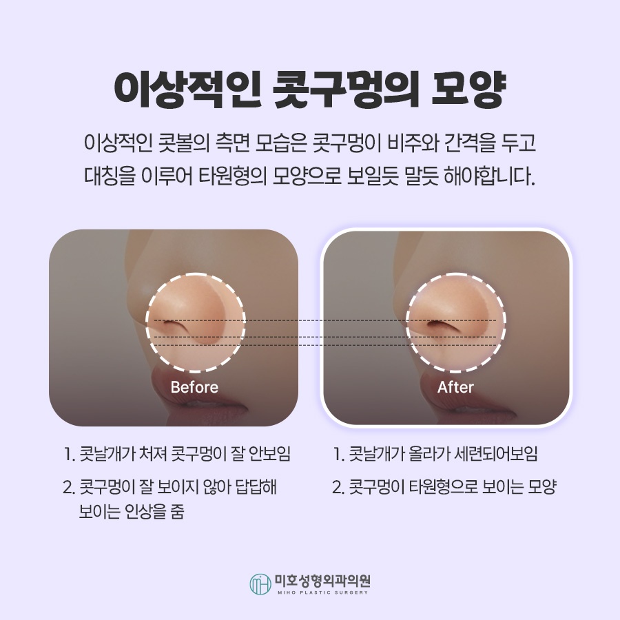 콧날개올리기 비익거상 기준 살펴보고 관련 이미지 4