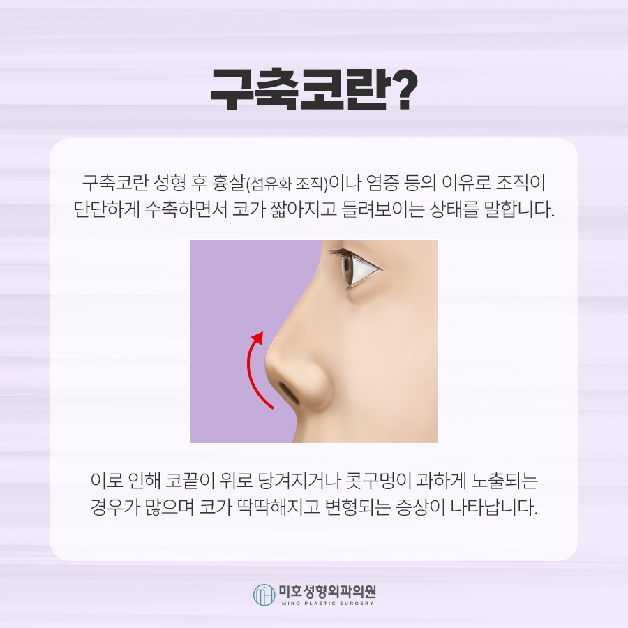 If You Need Contracted Nose Reconstruction image 2