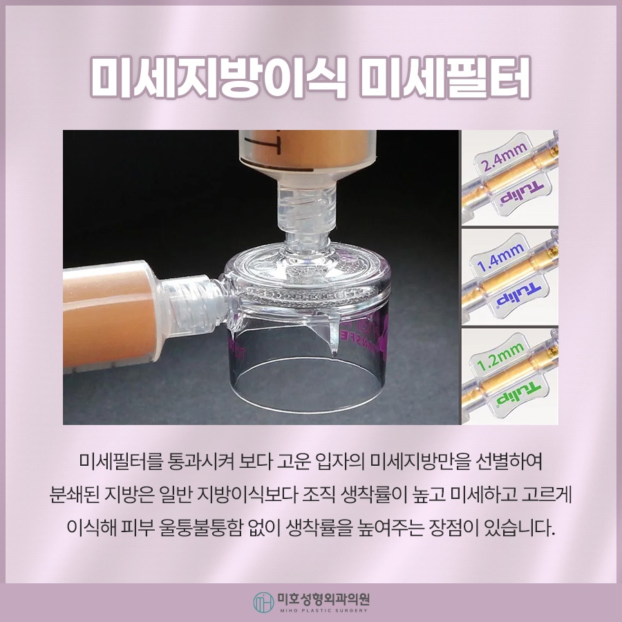 눈밑미세지방이식 올바른 계획으로 관련 이미지 3