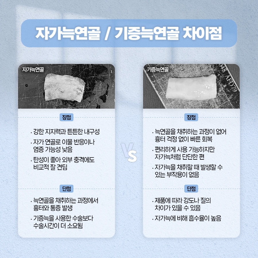 자가늑코수술 재료 특성과 회복 과정 관련 이미지 4