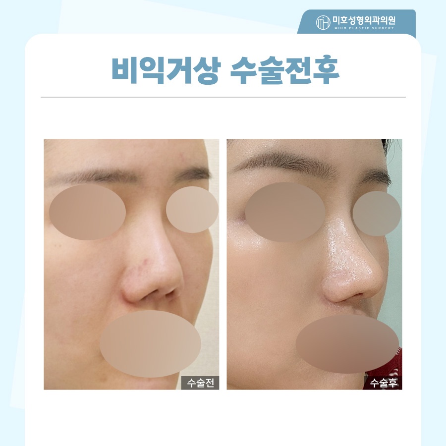 비익거상 개개인별 맞는 비율로 관련 이미지 8