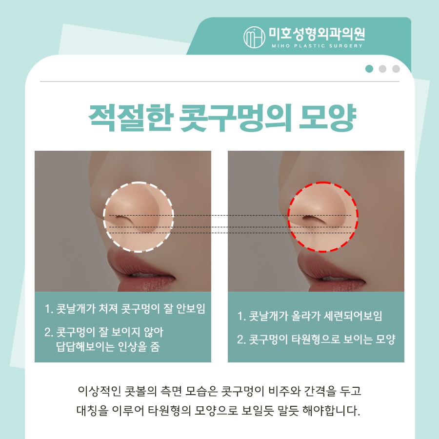 미호 비익거상 자연스러운 콧날개올리기 비율교정! 관련 이미지 4