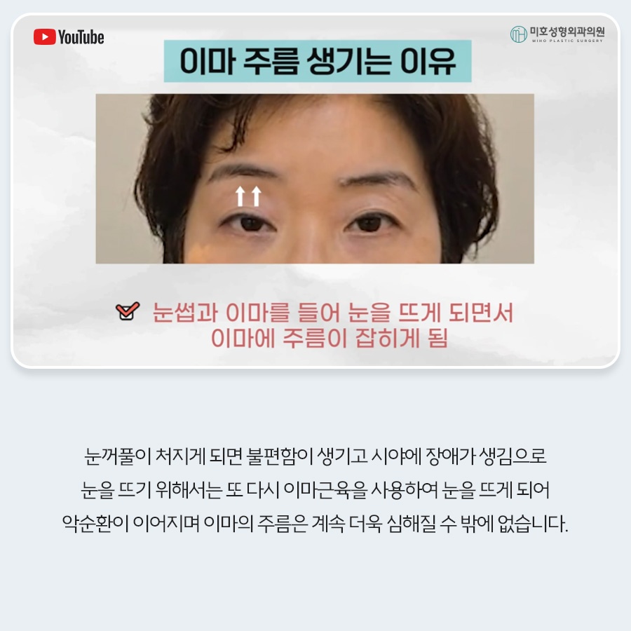 이마거상비용 방법 비교 관련 이미지 4