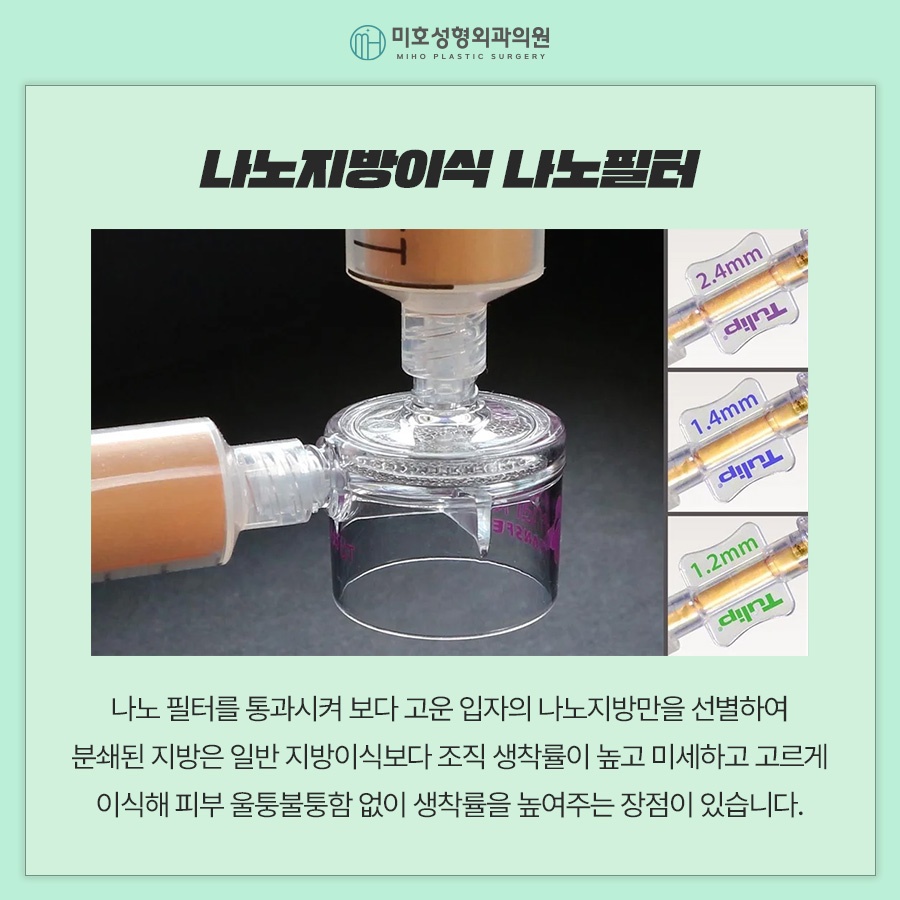 일반 눈밑지방이식과 나노지방이식의 차이점 관련 이미지 5