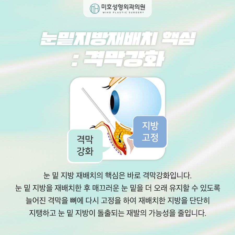 눈밑지방재배치후기 비교분석 하길 원한다면 관련 이미지 4