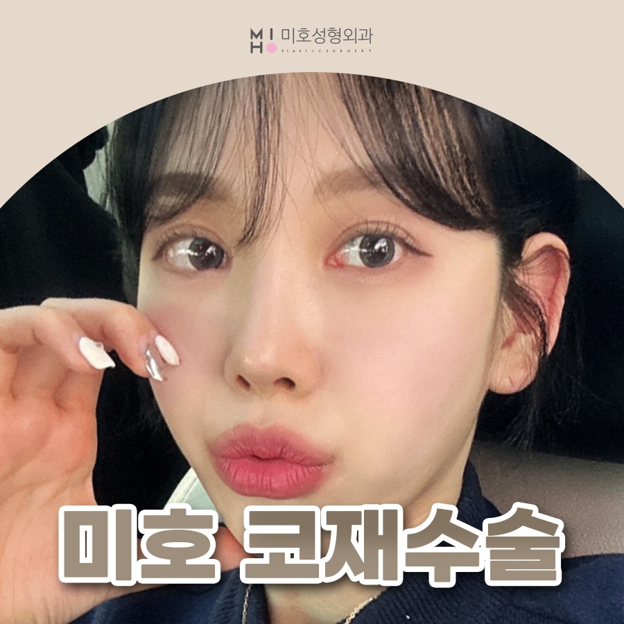 Revision Rhinoplasty Cost: Proceed Carefully, Since This Is a Second Attempt image 1