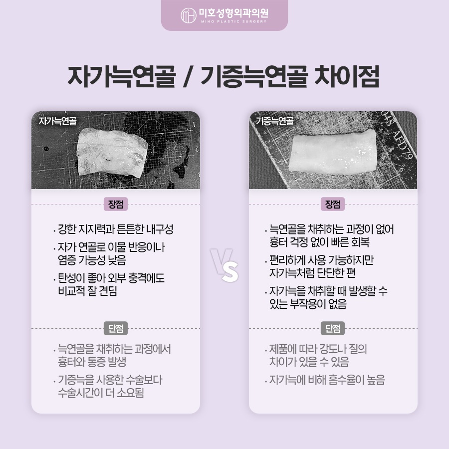 자가늑코수술 흉터와 통증이 걱정된다면 관련 이미지 4