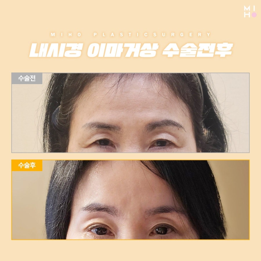 이마거상술후기 고려할 부분은 관련 이미지 21