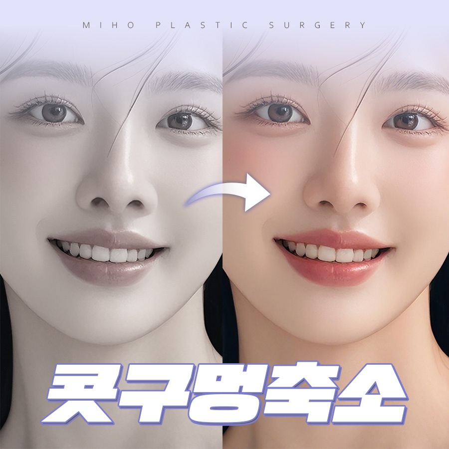 Refining Nostril Reduction in a Sophisticated Way image 1