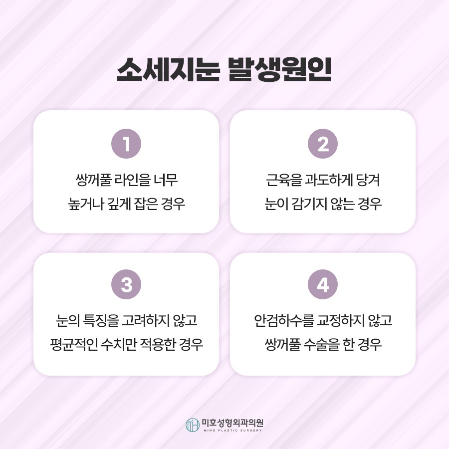 소세지눈재수술 적용 방식 2가지 관련 이미지 4