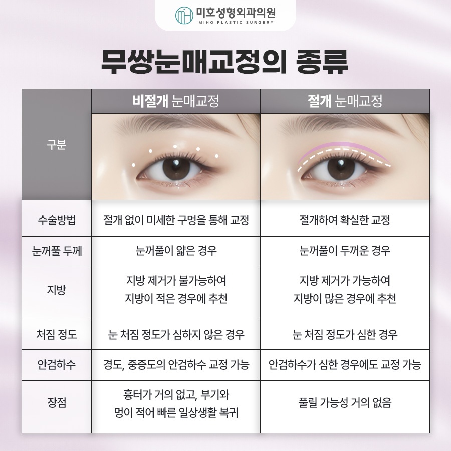 How to Make Your Eyes Bigger Without Double Eyelids: Ptosis Correction for Monolids image 4