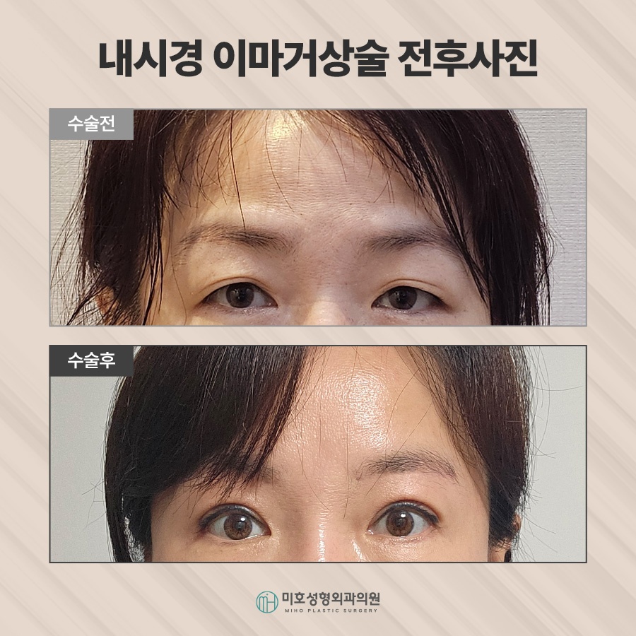 이마거상후기 진행과정 및 체크할 점 관련 이미지 8