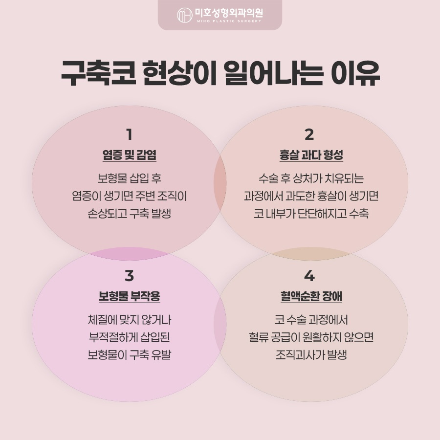 구축코재수술 코끝이 들리고 짧아졌다면 확인해야 할 것 관련 이미지 5