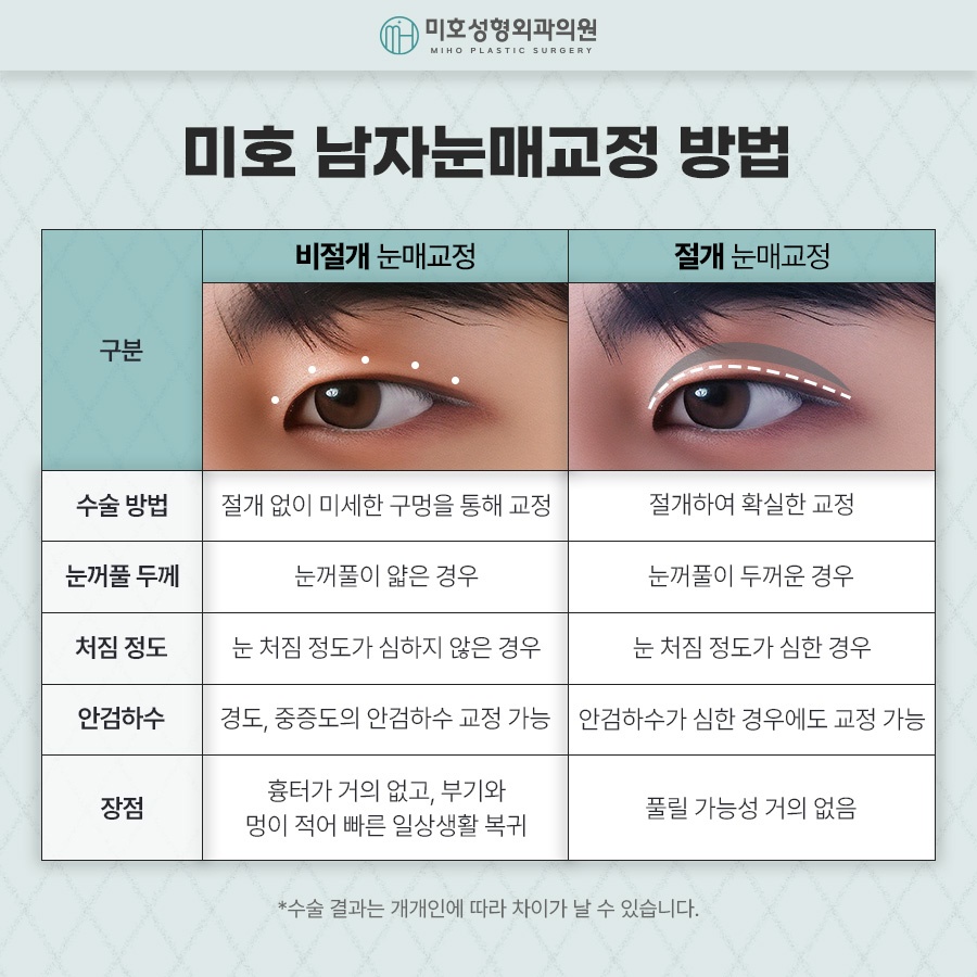 Naturally Defined Eyes with Male Eye-Shape Correction image 3