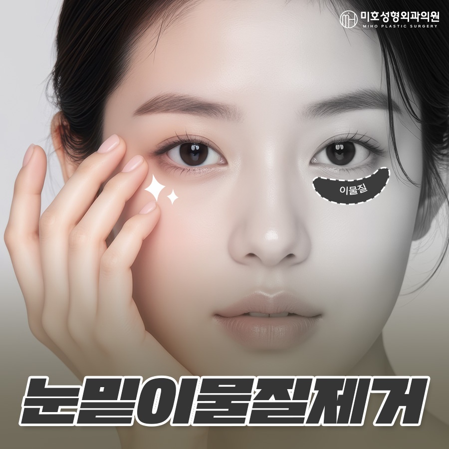 Under-Eye Fat Grafting and Filler Lumps: Addressing Side Effects Through Under-Eye Fat Repositioning and Foreign-Material Removal image 1