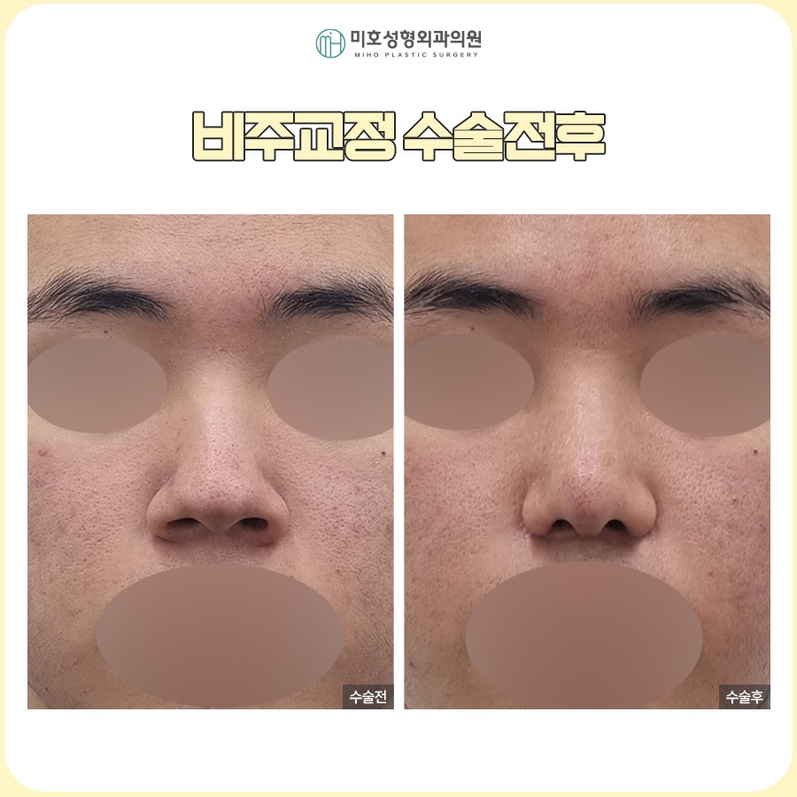비주내리기 입체적이고 세련된 옆라인을 만드는 방법 관련 이미지 7