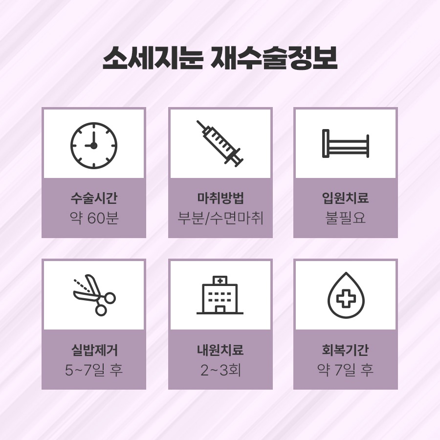 소세지눈재수술 적용 방식 2가지 관련 이미지 6