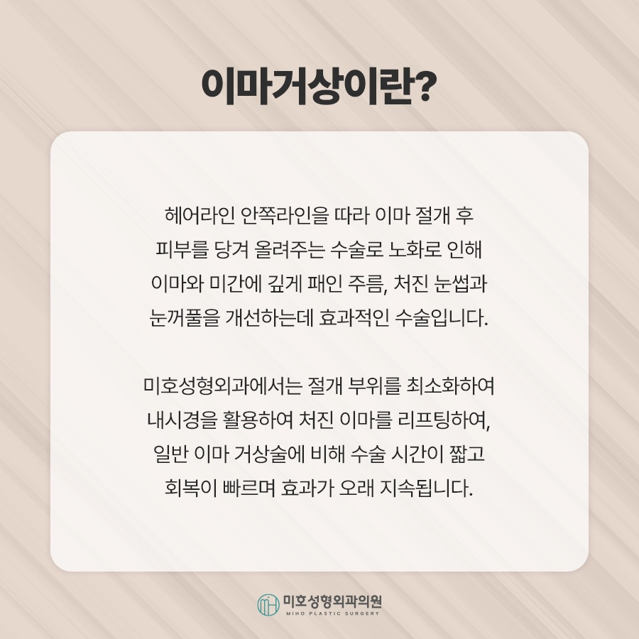 이마거상후기 진행과정 및 체크할 점 관련 이미지 2