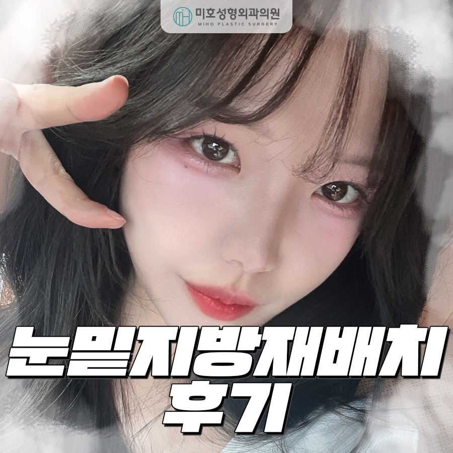 눈밑지방재배치후기 비교분석 하길 원한다면 관련 이미지 1