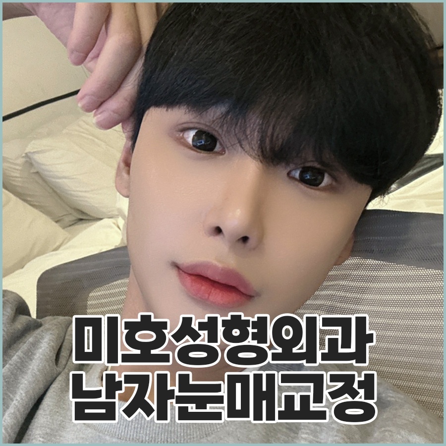 Naturally Defined Eyes with Male Eye-Shape Correction image 1