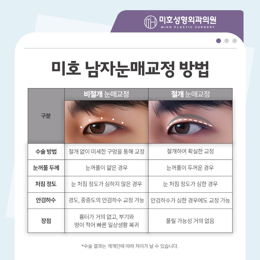 Focusing on a Natural Look in Male Eye Surgery image 4
