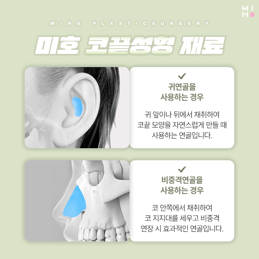 코끝성형 오똑하고 자연스럽게 관련 이미지 14
