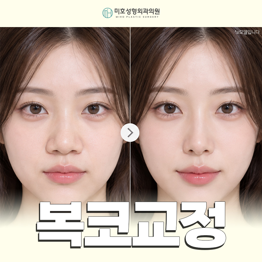 복코교정이란? 복코 원인부터 수술방법, 회복기간까지 알아보기 관련 이미지 1