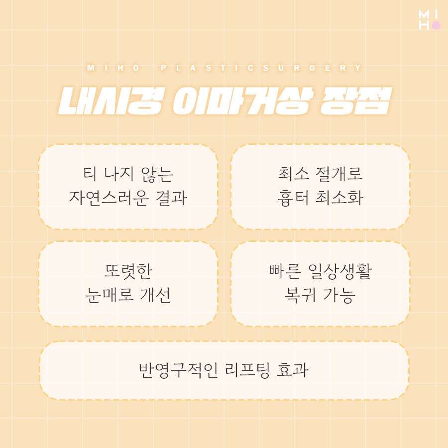 이마거상술후기 고려할 부분은 관련 이미지 3