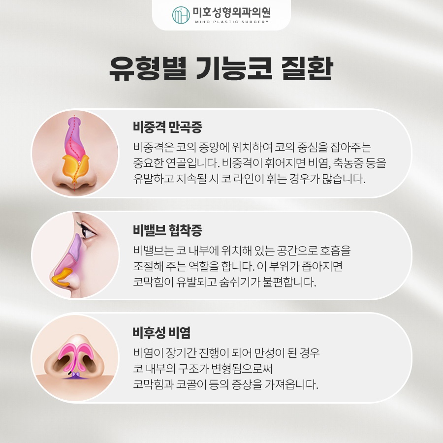 기능코 교정의 중요성 관련 이미지 3