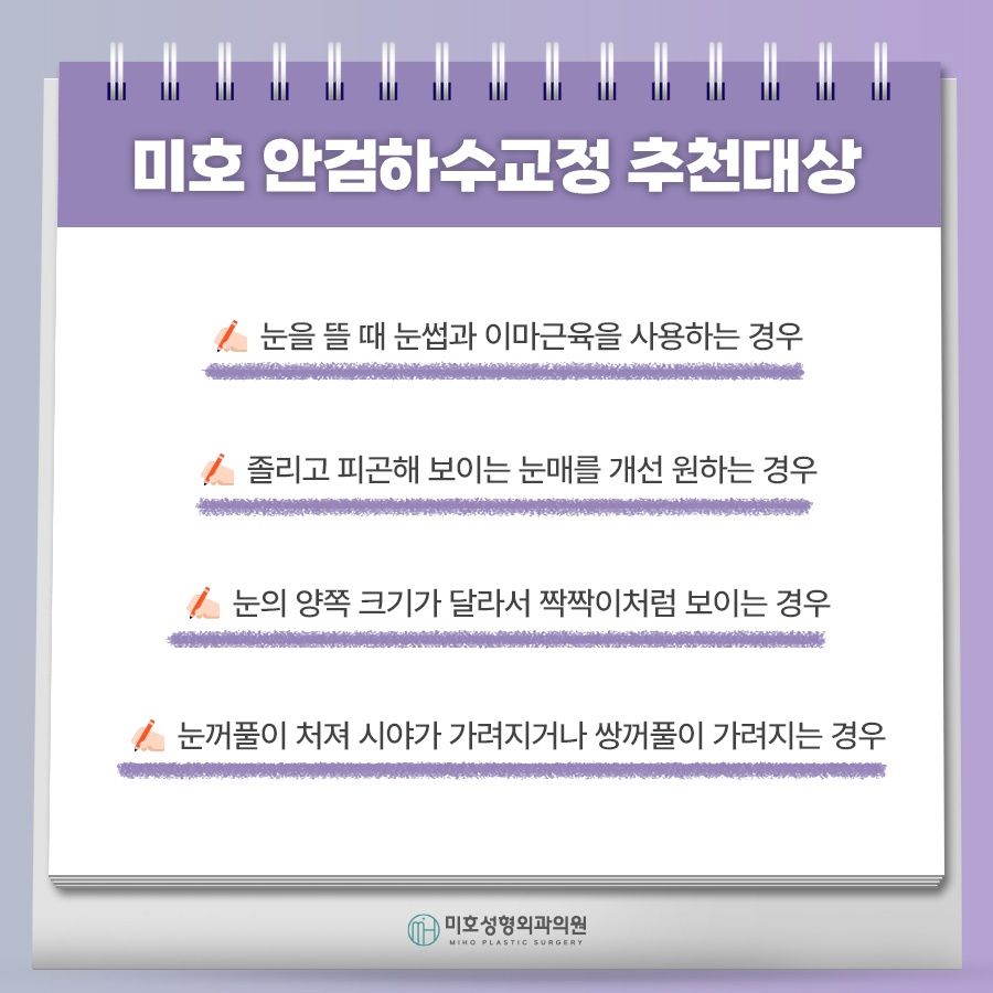 남자안검하수 자연스러움을 바탕으로 관련 이미지 4