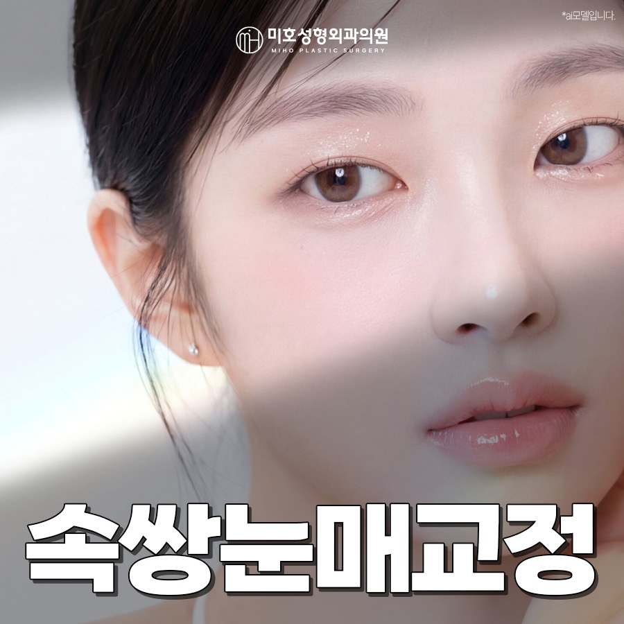 속쌍눈매교정 또렷한 눈매를 원할때 관련 이미지 1