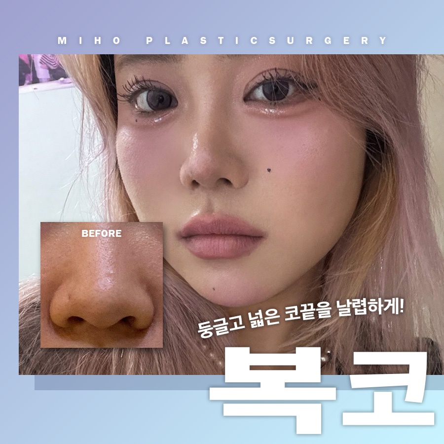 복코 교정 관상까지 좋아지려면 관련 이미지 1