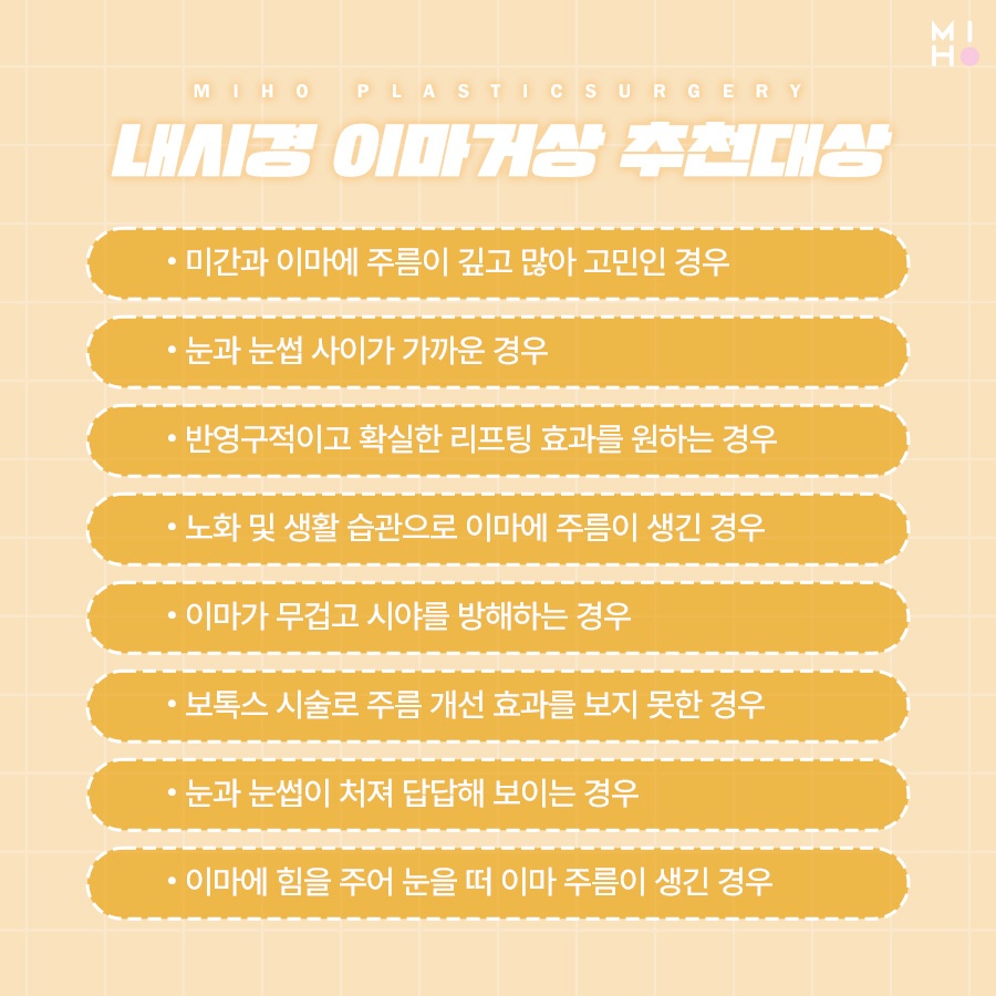 이마거상술후기 고려할 부분은 관련 이미지 4