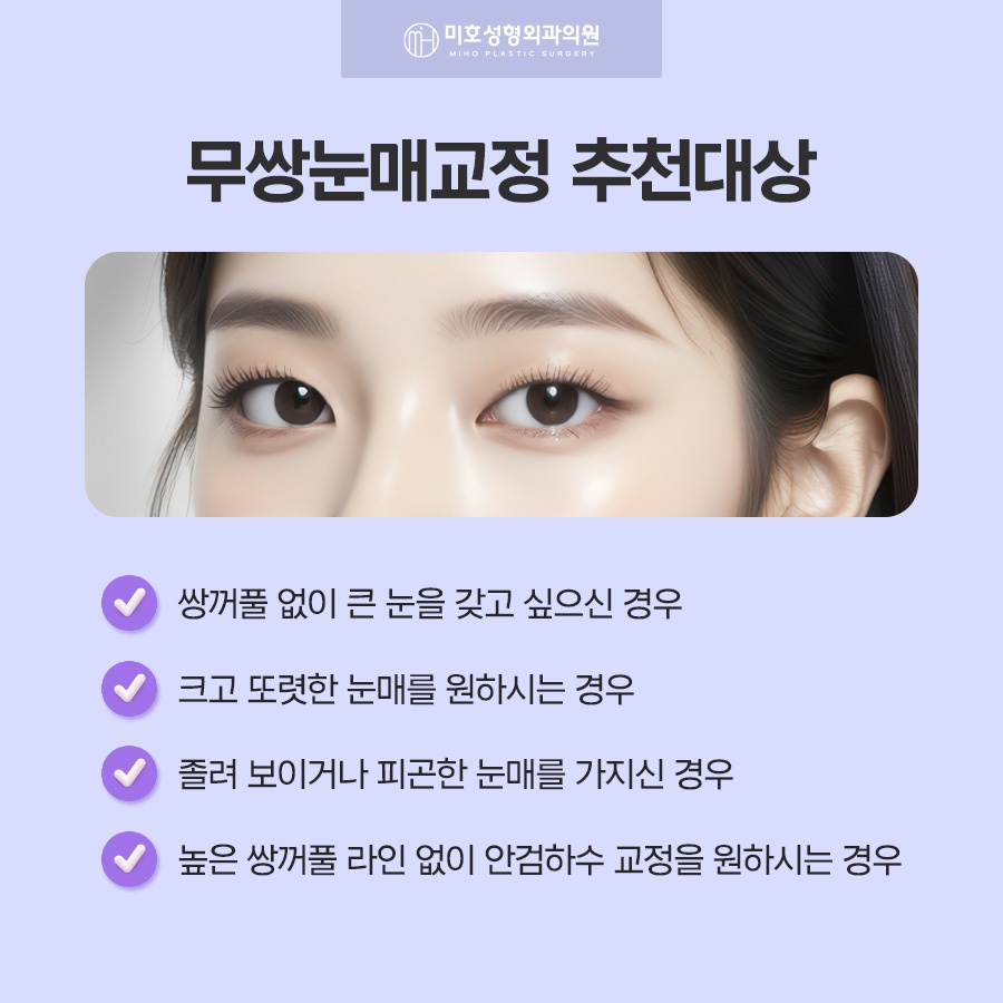 무쌍눈매교정 쌍꺼풀 없이 크고 또렷한 눈으로 관련 이미지 3