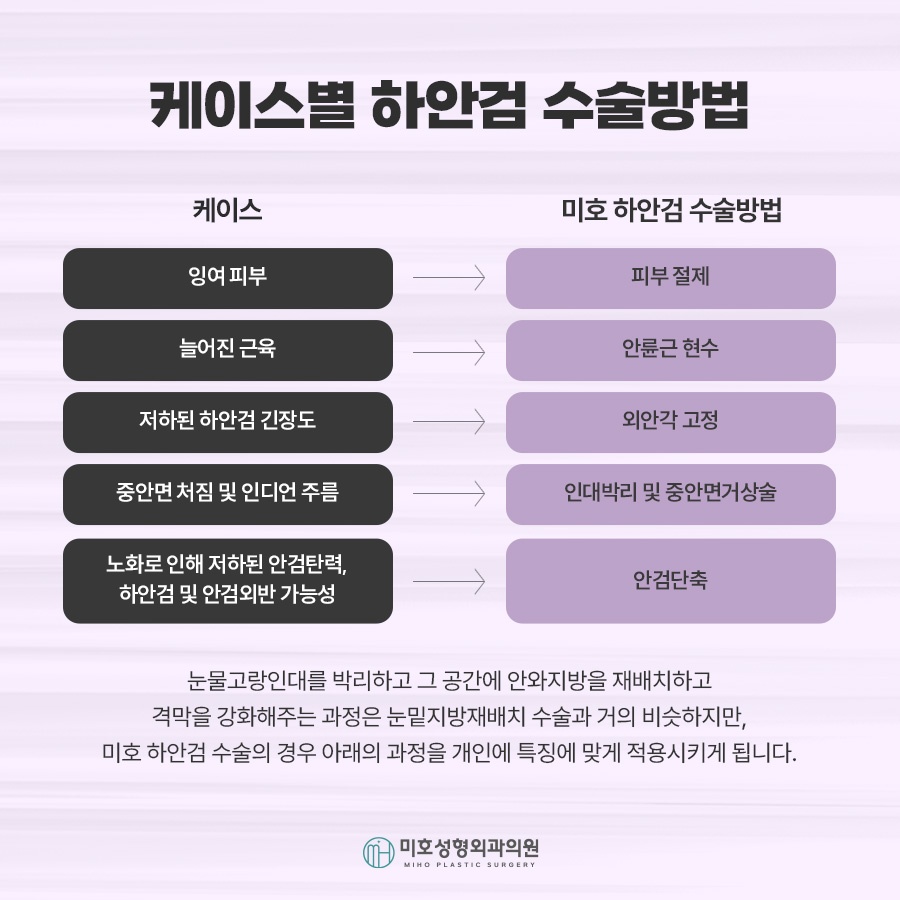 상하안검수술 처진 눈꺼풀 개선 방법 관련 이미지 5