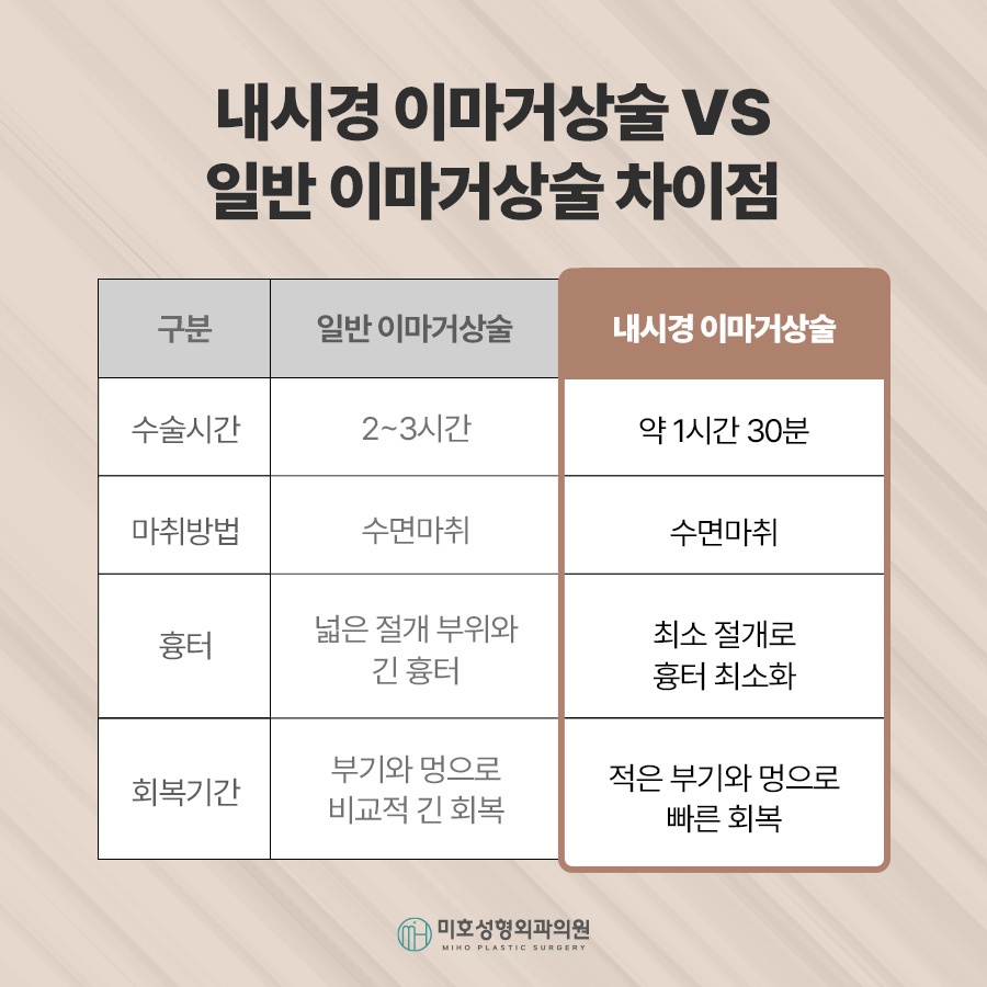 이마거상후기 진행과정 및 체크할 점 관련 이미지 4