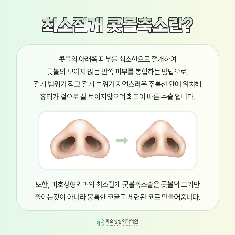 A Successful Guide to Male Alar Reduction for a Refined Appearance image 2