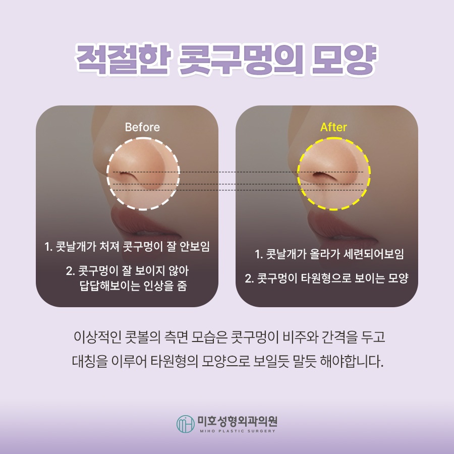 콧날개올리기 개개인에게 맞는 방식으로 관련 이미지 4
