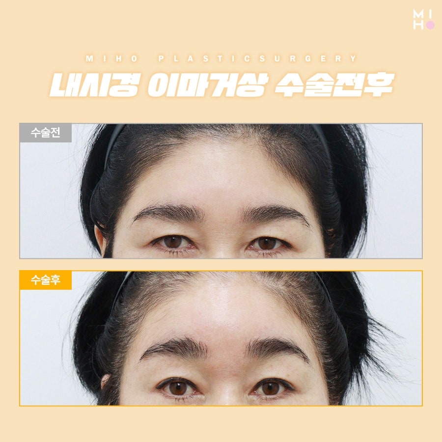 이마거상술후기 고려할 부분은 관련 이미지 22