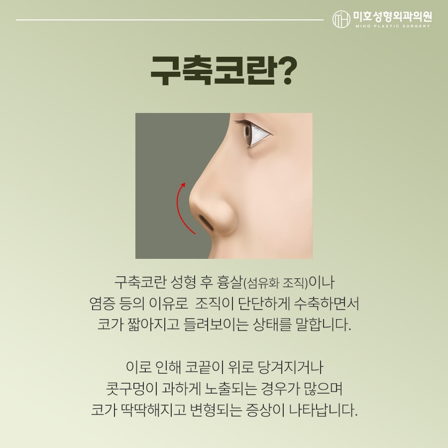 Identify the Cause of a Contracted Nose Before Attempting Revision image 2