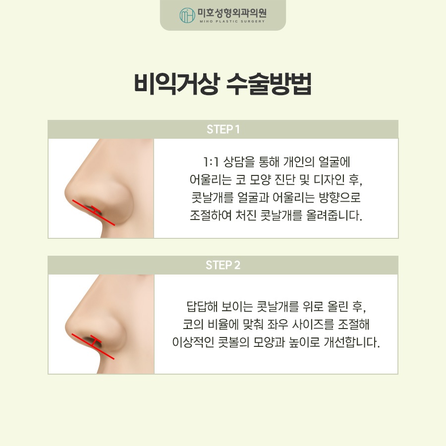 비익거상으로 예쁜 코 만드는 비결 총정리 관련 이미지 4