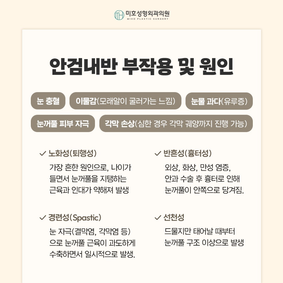 안검내반수술 눈물과 자극이 반복된다면 관련 이미지 5