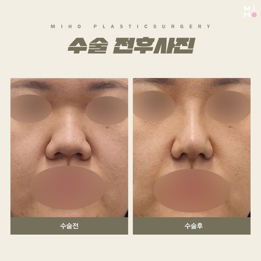 비익거상 깔끔한 과정을 위해서 관련 이미지 9