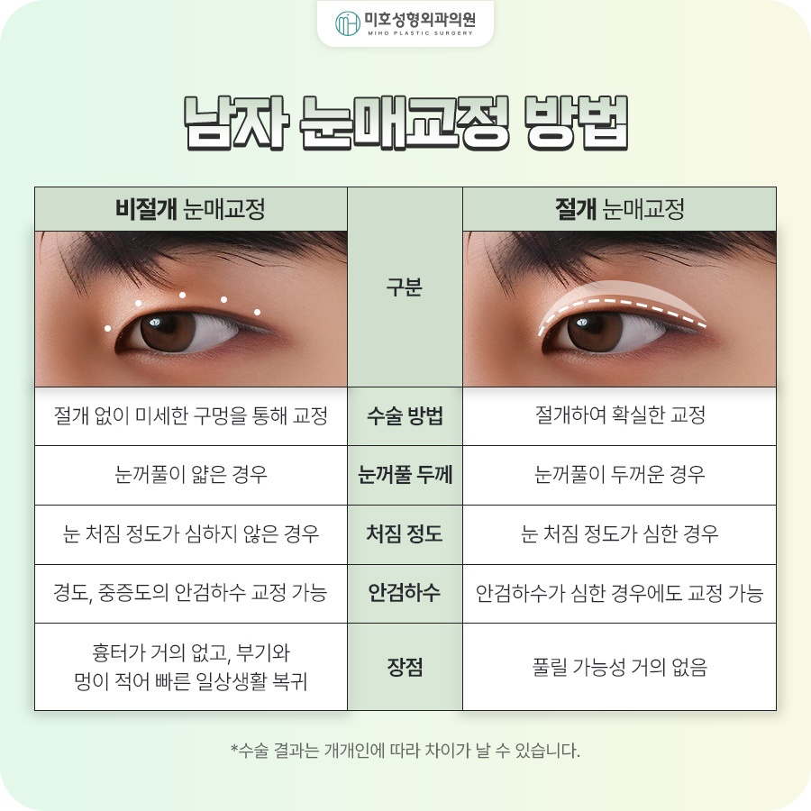 남자눈매교정 졸려 보이는 인상이 고민이라면 관련 이미지 4